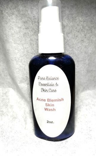 Acne Blemish Wash 2oz bottle with a pump dispenser for gentle cleansing.